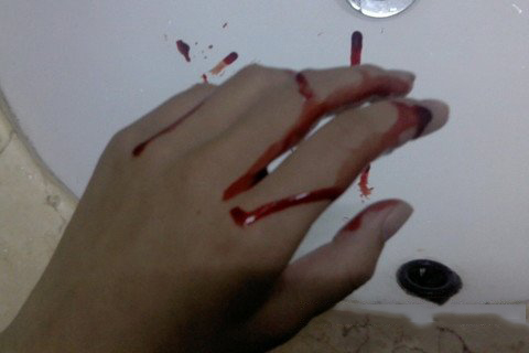 梦见切到手 割破手