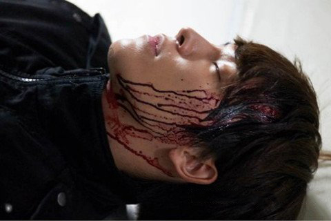 梦见别人身上流血