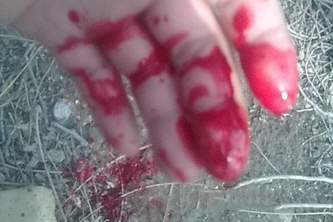 孕妇梦见别人流血