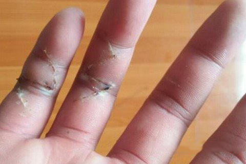 梦见无名指断了