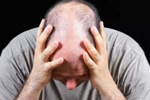 梦见大把大把掉头发